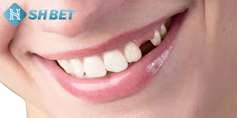 Giải mã chi tiết điềm báo của giấc chiêm bao rụng răng