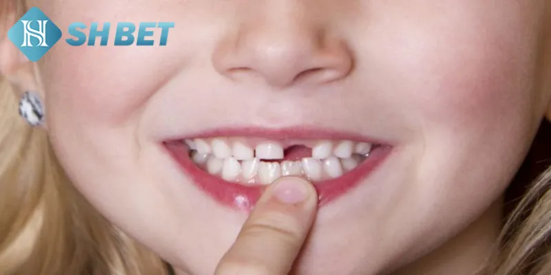 Tổng hợp các con số tài lộc khi chiêm bao rụng răng